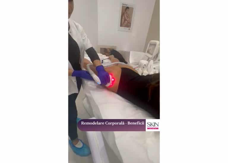 PowerShape™ 2: Drenaj Limfatic Avansat cu Cap Multipolar, Radiofrecvență și Vacuum - imagine 2