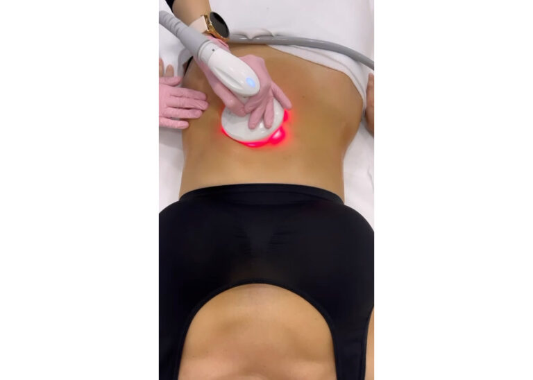 Tratament anticelulită și remodelare corporală cu Powershape™2 - imagine 5