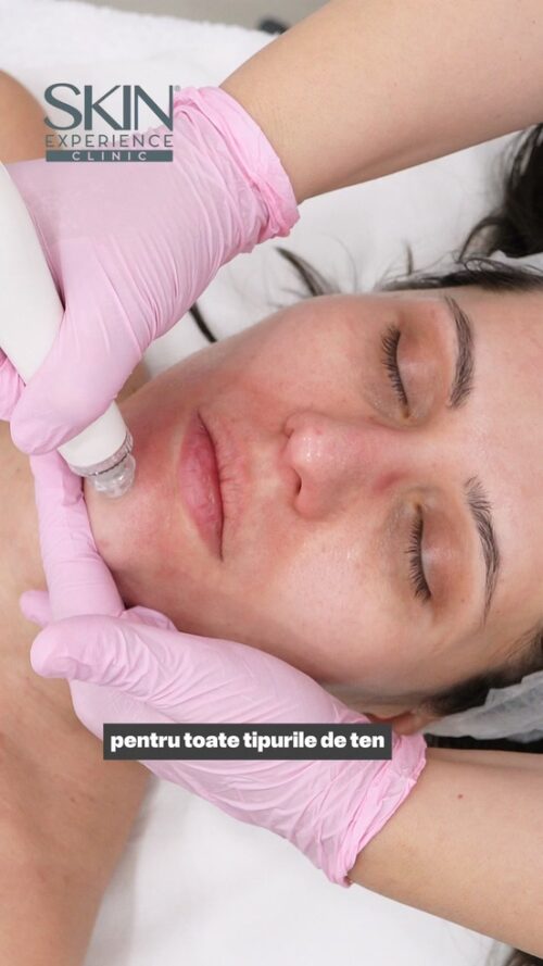 Tratament facial HydraBeauty 2 - imagine 2