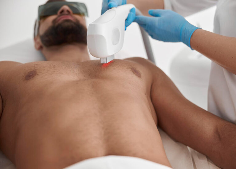 Epilare definitivă bărbați Clearlight™ LD808