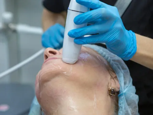 lifting facial hifu