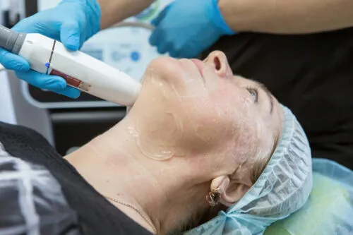lifting facial hifu