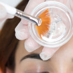 Colombia Peel Mediderma – Tratament profesional pentru hiperpigmentare