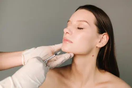 Injectare acid hialuronic