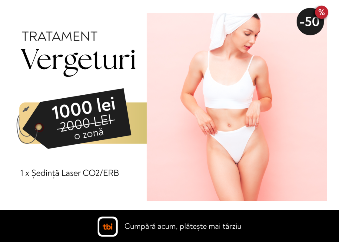 Site Vergeturi