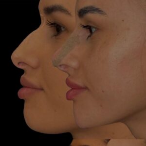 dr-hamed-rawnak-injectari (2)